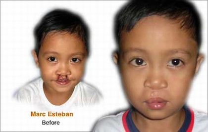 Marc Esteban Marc Esteban